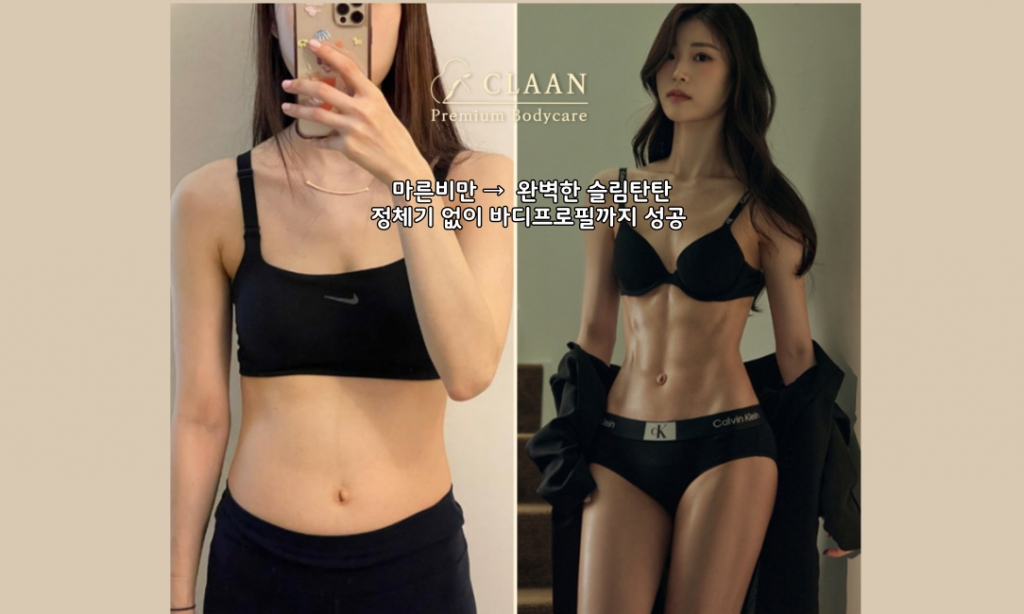 마른비만 군살제거+바프까지 성공! 